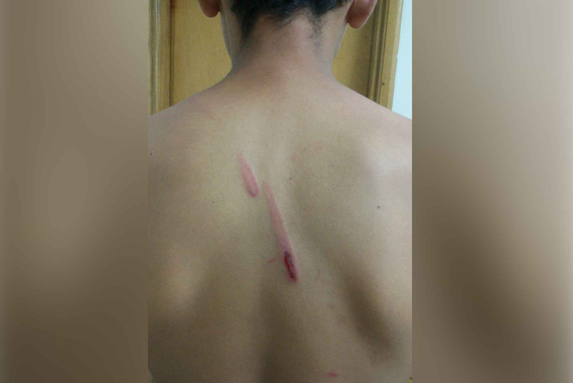 Denuncian caso de presunta agresión política en Lorica