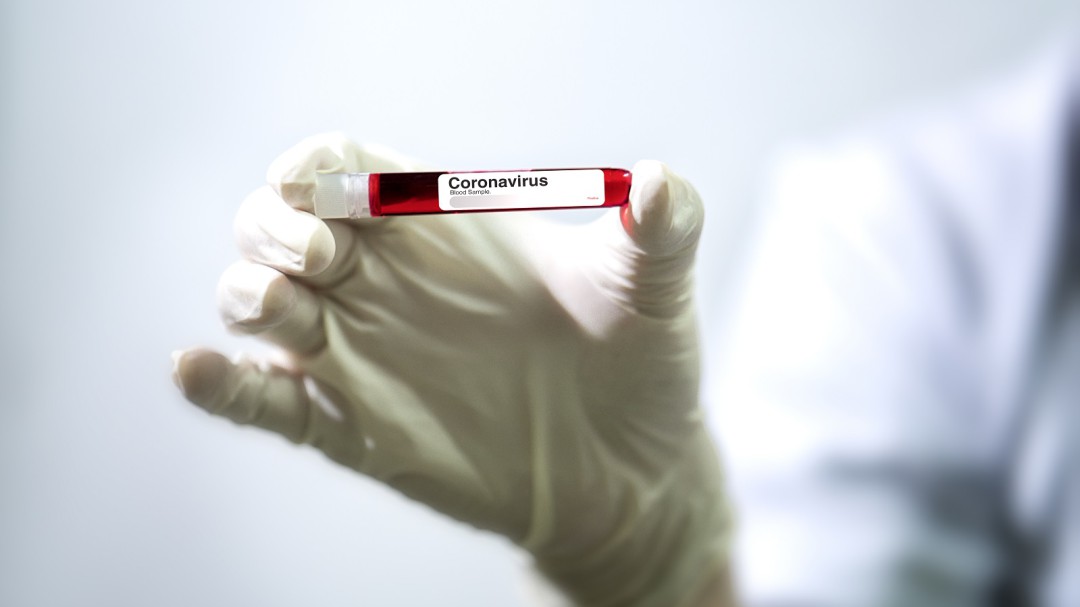 Prueba Coronavirus